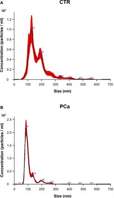 Plasmatic Exosome Number and Size Distinguish Prostate Cancer Patients From Healthy Individuals: A Prospective Clinical Study